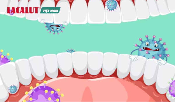 vi khuẩn mảng bám gây viêm nướu